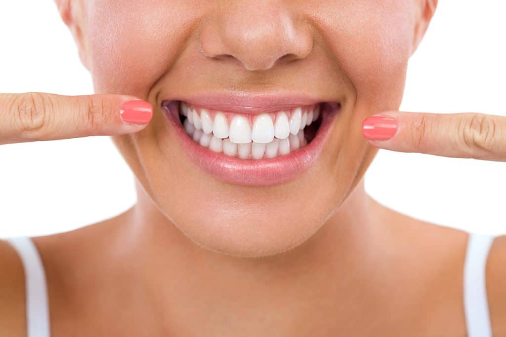 How Long Does Professional Teeth Whitening Last?