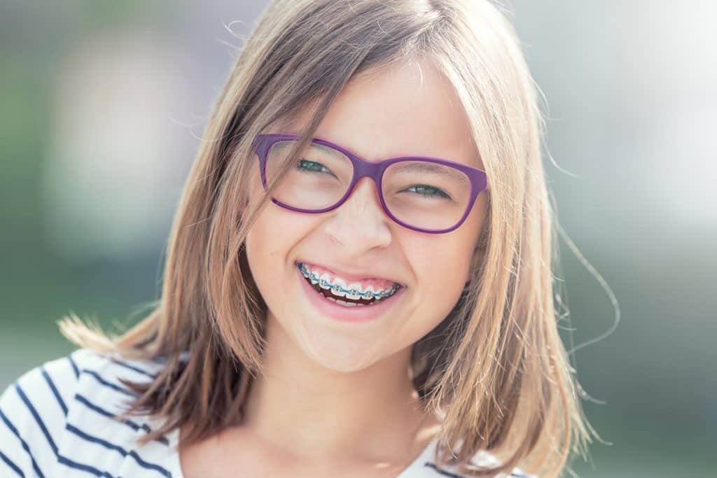 How to Fix Uneven Teeth Without Braces
